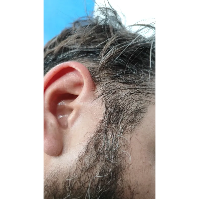 BRACCIO OSCILLANTE SOSP. ANT. SX. NISSAN MICRA (K13K) (09/10-) 1.2 12V BER. 5P/B/1198CC